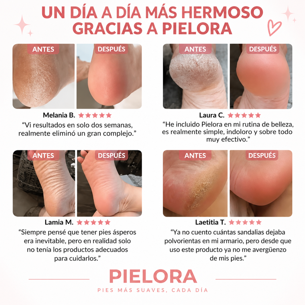 Pielora Silk Pro – Lima eléctrica para pies